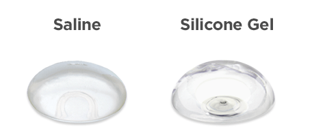 Breast-implant-option