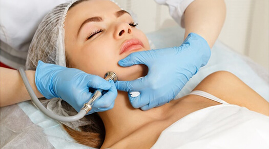 Dermabrasion - Dr Abizer Kapadia