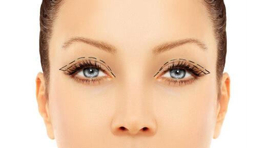 Face & Neck - Eyelid Surgery- Blepharoplasty - Dr Abizer Kapadia