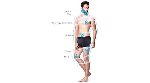 Male-Specific Plastic Surgery - Body Toning and Contouring – Arms & Calves - Dr Abizer Kapadia