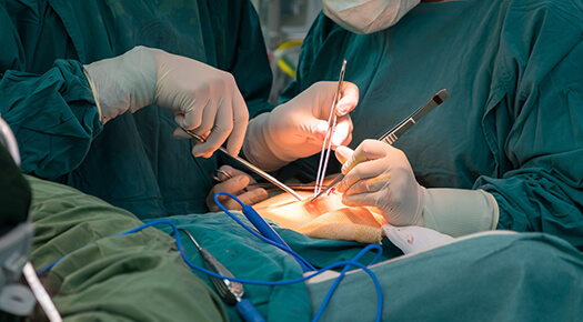 Surgical Treatments - Dr Abizer Kapadia