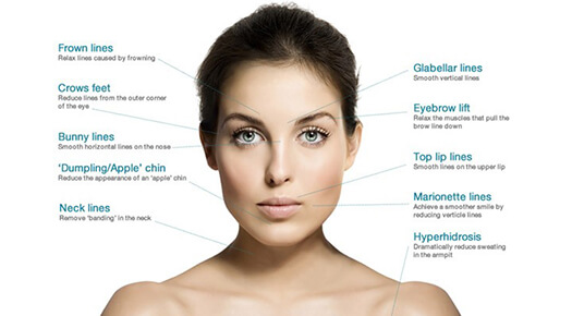 botox - Dr Abizer Kapadia