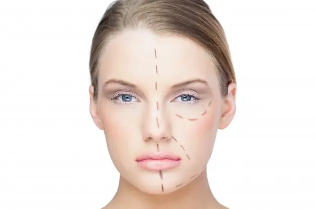 liquid facelift