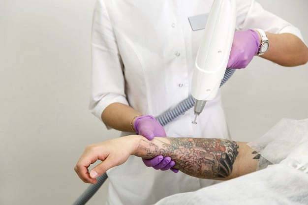Tattoo removal banner