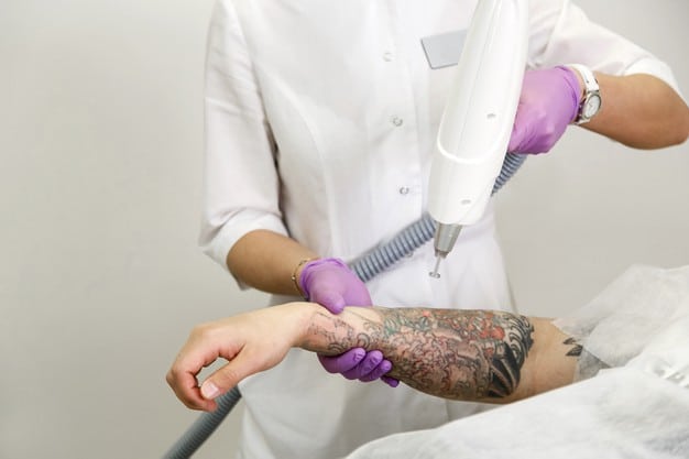 tattoo removal banner