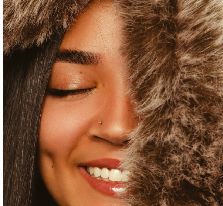 Dimple Creation Surgery