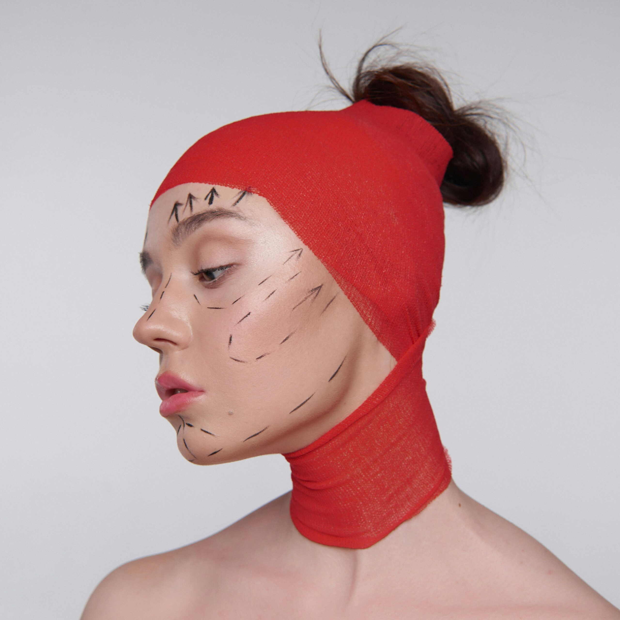 Facelift Surgery