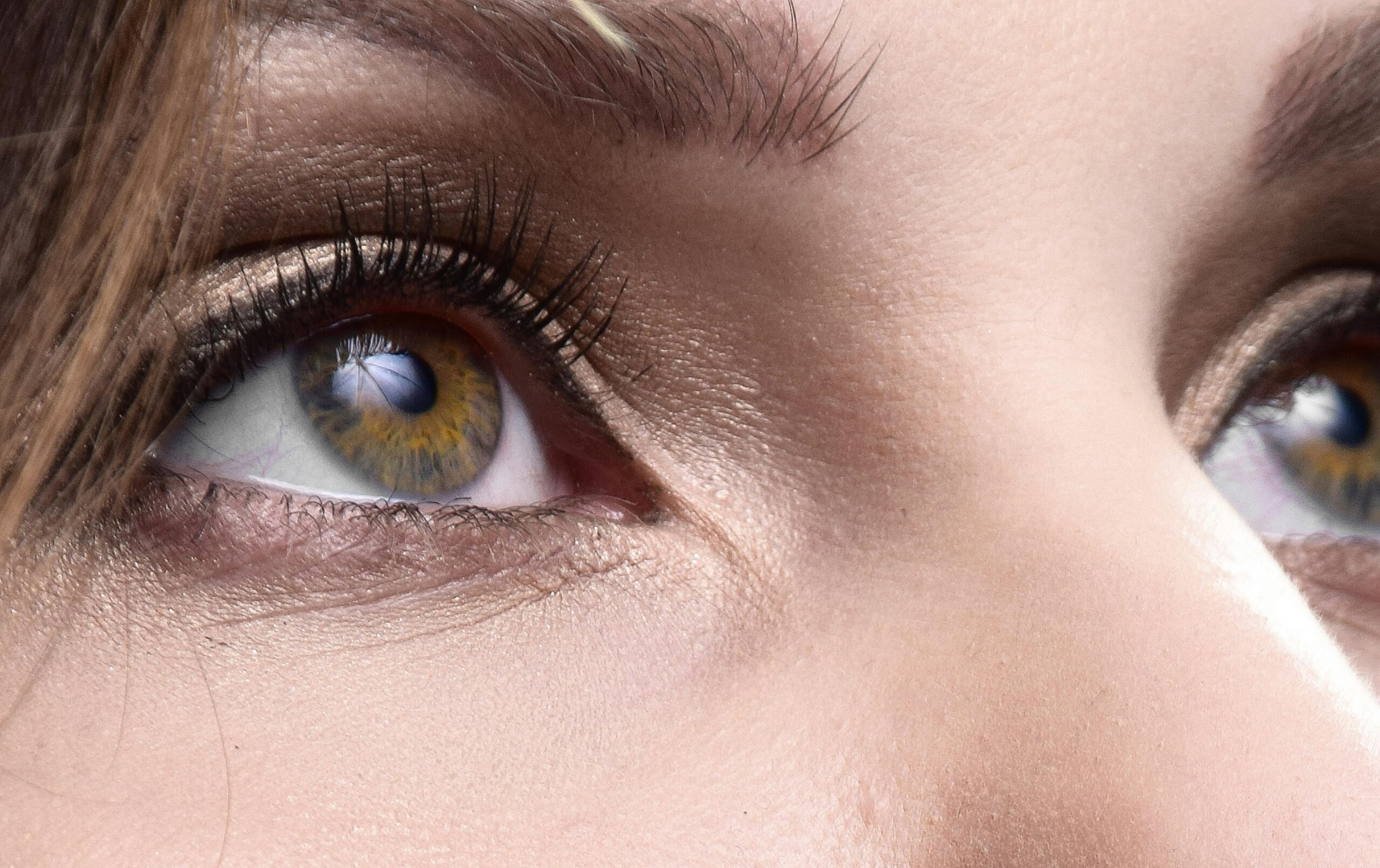 Blepharoplasty