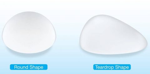 Breast-implant-shape